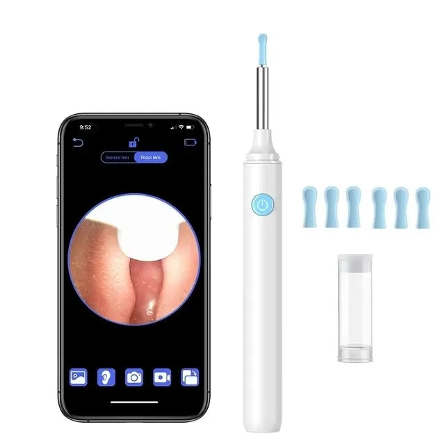 Find B GP WiFi Ear Endoscope