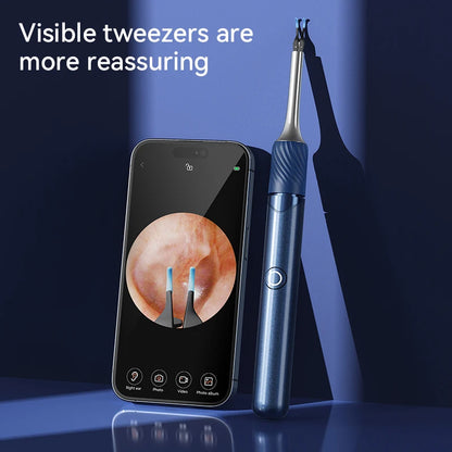 Find B GP WiFi Ear Endoscope